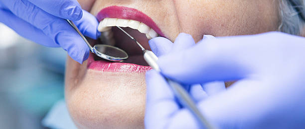 Best Emergency Root Canal Treatment in Clendenin, WV